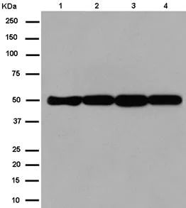 Western blot - Anti-FH/Fumarase antibody [EPR11647(2)(B)] - N-terminal (AB184945)