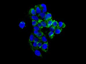 Immunocytochemistry/ Immunofluorescence - Anti-FH/Fumarase antibody [EPR11648] (AB171948)