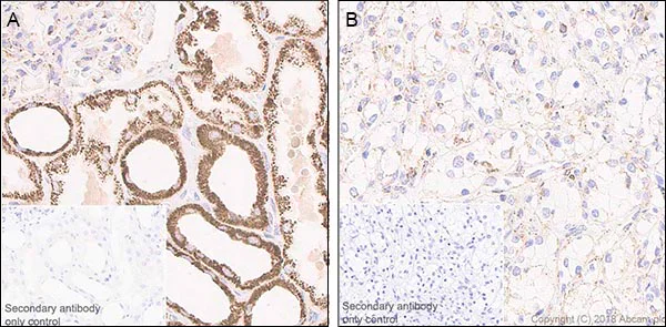 Immunohistochemistry (Formalin/PFA-fixed paraffin-embedded sections) - Anti-FH/Fumarase antibody [EPR21104] (AB233394)