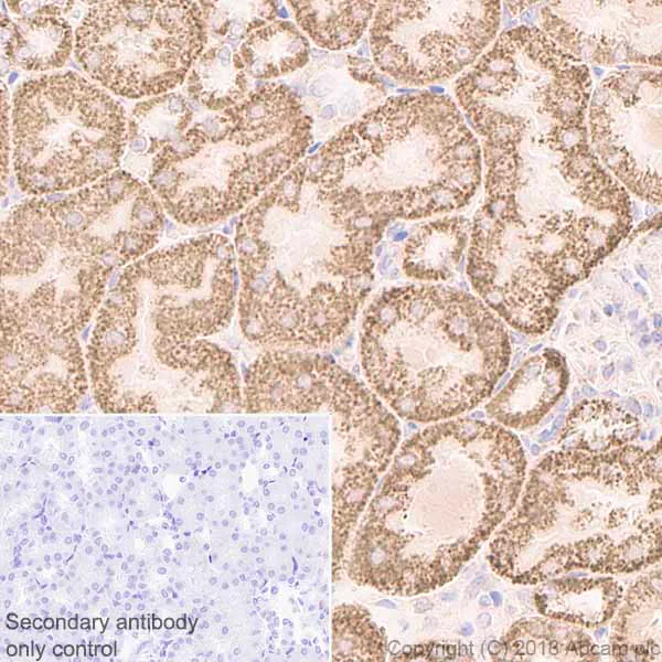 Immunohistochemistry (Formalin/PFA-fixed paraffin-embedded sections) - Anti-FH/Fumarase antibody [EPR21104] (AB233394)
