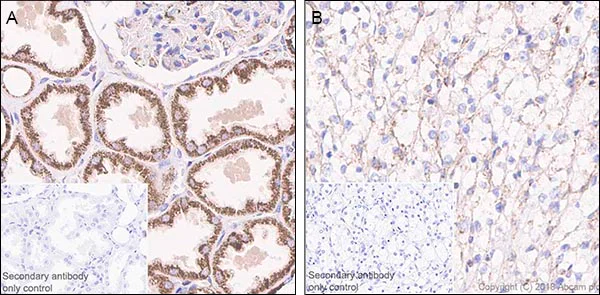 Immunohistochemistry (Formalin/PFA-fixed paraffin-embedded sections) - Anti-FH/Fumarase antibody [EPR21105] (AB233393)