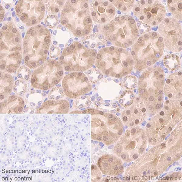 Immunohistochemistry (Formalin/PFA-fixed paraffin-embedded sections) - Anti-FH/Fumarase antibody [EPR21105] (AB233393)