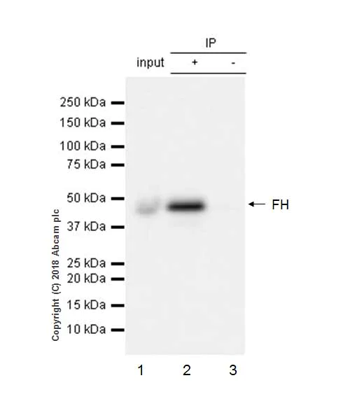 Immunoprecipitation - Anti-FH/Fumarase antibody [EPR21105] (AB233393)
