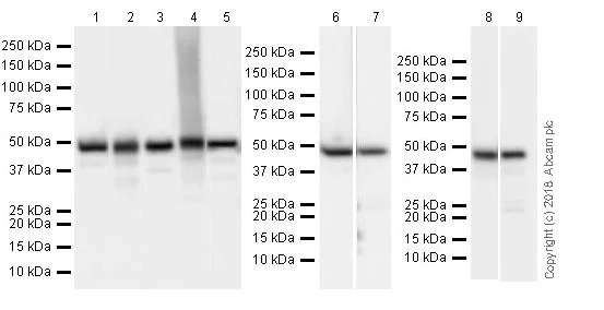 Western blot - Anti-FH/Fumarase antibody [EPR21105] (AB233393)
