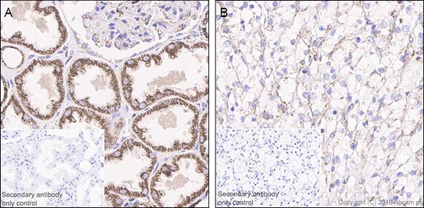 Immunohistochemistry (Formalin/PFA-fixed paraffin-embedded sections) - Anti-FH/Fumarase antibody [EPR21105] - BSA and Azide free (AB234907)