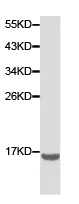 Western blot - Anti-FHIT antibody (AB180806)