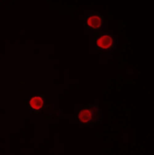Immunocytochemistry/ Immunofluorescence - Anti-FHIT antibody - C-terminal (AB181004)