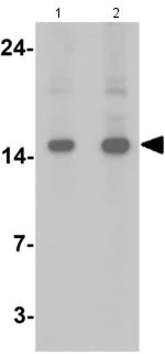 Western blot - Anti-FHIT antibody - C-terminal (AB181004)