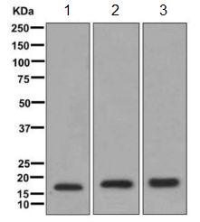 Western blot - Anti-FHIT antibody [EPR10931] (AB170888)