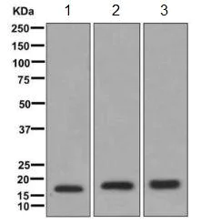 Western blot - Anti-FHIT antibody [EPR10931] (AB170888)