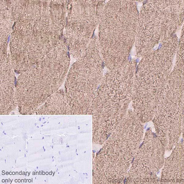Immunohistochemistry (Formalin/PFA-fixed paraffin-embedded sections) - Anti-FHL1 antibody [EPR22842-95] (AB255828)