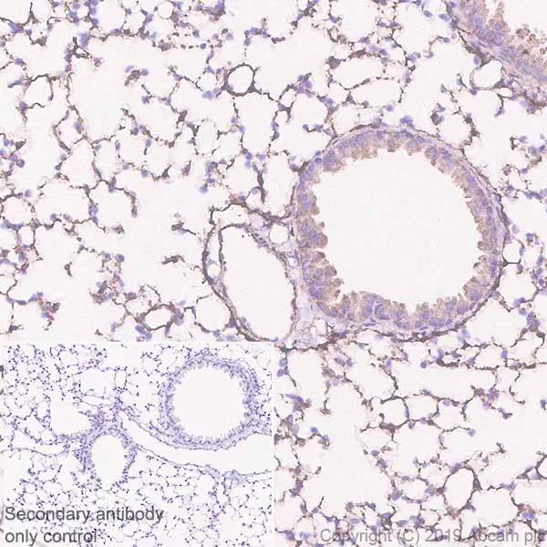 Immunohistochemistry (Formalin/PFA-fixed paraffin-embedded sections) - Anti-FHL1 antibody [EPR22842-95] (AB255828)