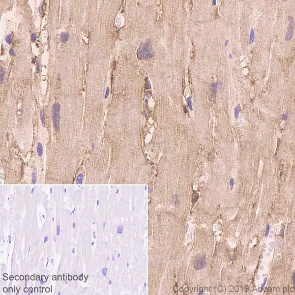 Immunohistochemistry (Formalin/PFA-fixed paraffin-embedded sections) - Anti-FHL1 antibody [EPR22842-95] (AB255828)