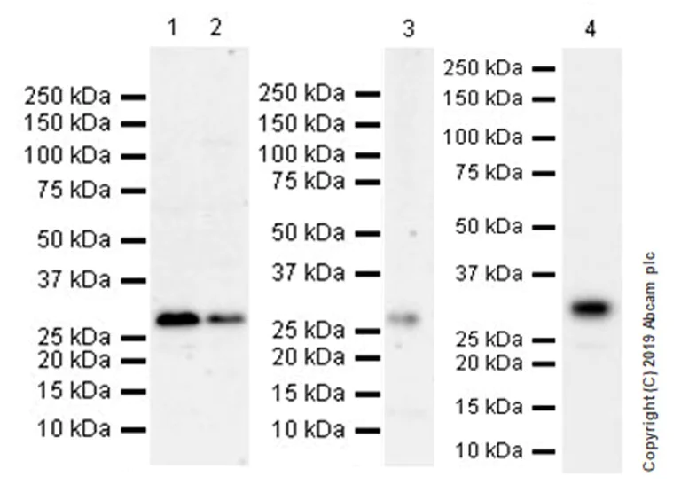 Western blot - Anti-FHL1 antibody [EPR22842-95] (AB255828)