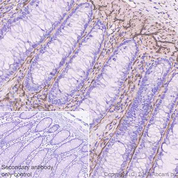Immunohistochemistry (Formalin/PFA-fixed paraffin-embedded sections) - Anti-FHL1 antibody [EPR22842-95] - BSA and Azide free (AB256551)