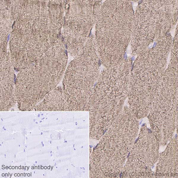 Immunohistochemistry (Formalin/PFA-fixed paraffin-embedded sections) - Anti-FHL1 antibody [EPR22842-95] - BSA and Azide free (ab256551), expandable thumbnail