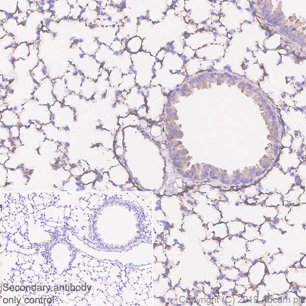 Immunohistochemistry (Formalin/PFA-fixed paraffin-embedded sections) - Anti-FHL1 antibody [EPR22842-95] - BSA and Azide free (ab256551), expandable thumbnail