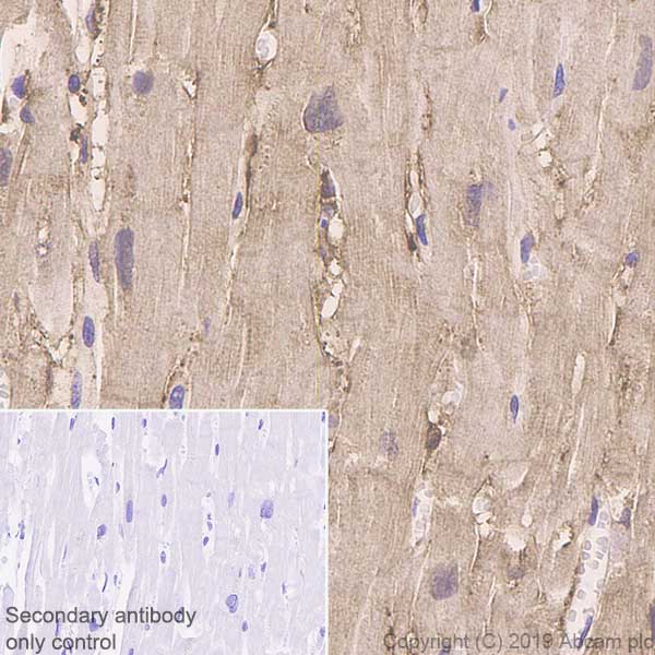 Immunohistochemistry (Formalin/PFA-fixed paraffin-embedded sections) - Anti-FHL1 antibody [EPR22842-95] - BSA and Azide free (ab256551), expandable thumbnail