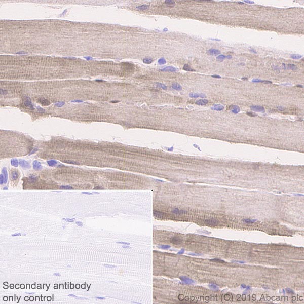 Immunohistochemistry (Formalin/PFA-fixed paraffin-embedded sections) - Anti-FHL1 antibody [EPR22842-95] - BSA and Azide free (ab256551), expandable thumbnail