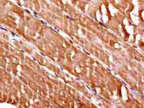 Immunohistochemistry (Formalin/PFA-fixed paraffin-embedded sections) - Anti-FHL1 antibody [EPR7520] (AB133661)