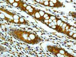 Immunohistochemistry (Formalin/PFA-fixed paraffin-embedded sections) - Anti-FHL1 antibody [EPR7520] - BSA and Azide free (AB248602)