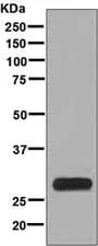 Western blot - Anti-FHL1 antibody [EPR7520] - BSA and Azide free (AB248602)