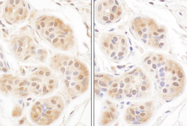 Immunohistochemistry (Formalin/PFA-fixed paraffin-embedded sections) - Anti-FHL2 antibody (AB12328)