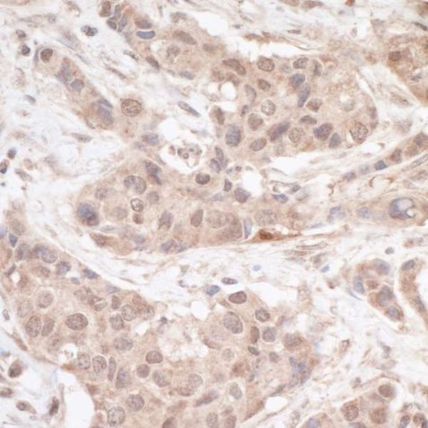 Immunohistochemistry (Formalin/PFA-fixed paraffin-embedded sections) - Anti-FHL2 antibody (AB12328)