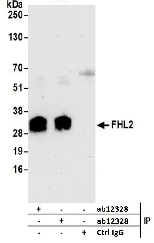 Immunoprecipitation - Anti-FHL2 antibody (AB12328)