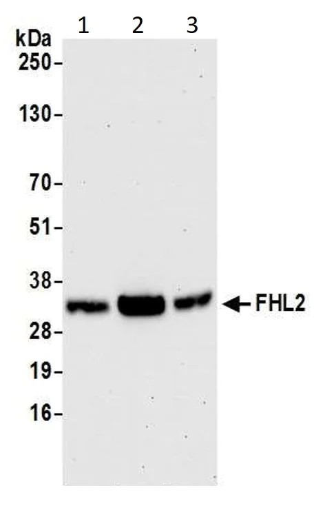 Western blot - Anti-FHL2 antibody (AB12328)