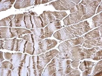 Immunohistochemistry (Formalin/PFA-fixed paraffin-embedded sections) - Anti-FHL2 antibody (AB137477)