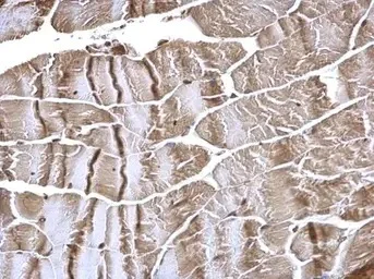 Immunohistochemistry (Formalin/PFA-fixed paraffin-embedded sections) - Anti-FHL2 antibody (AB137477)