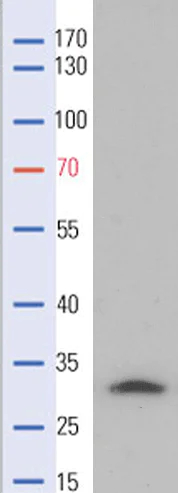 Western blot - Anti-FHL2 antibody (AB137477)