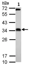 Western blot - Anti-FHL2 antibody (AB137477)