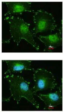 Immunocytochemistry/ Immunofluorescence - Anti-FHL2 antibody - C-terminal (AB153816)