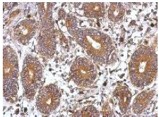 Immunohistochemistry (Formalin/PFA-fixed paraffin-embedded sections) - Anti-FHL2 antibody - C-terminal (AB153816)