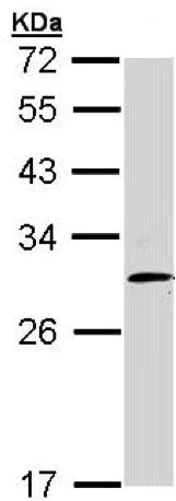 Western blot - Anti-FHL2 antibody - C-terminal (AB153816)