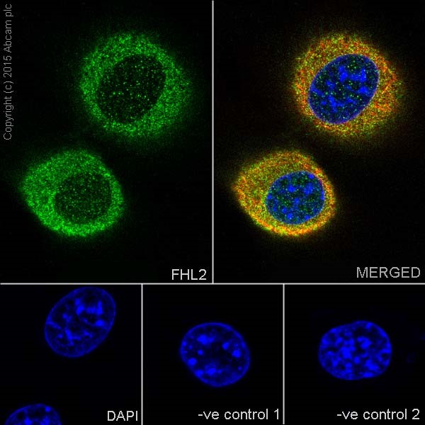 Immunocytochemistry/ Immunofluorescence - Anti-FHL2 antibody [EPR17860-20] (AB202584)