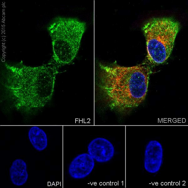 Immunocytochemistry/ Immunofluorescence - Anti-FHL2 antibody [EPR17860-20] (AB202584)