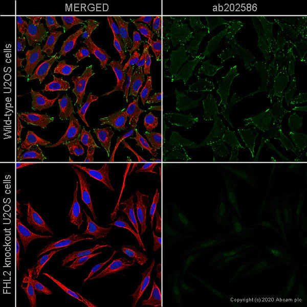 Immunocytochemistry/ Immunofluorescence - Anti-FHL2 antibody [EPR17860-23] (AB202586)