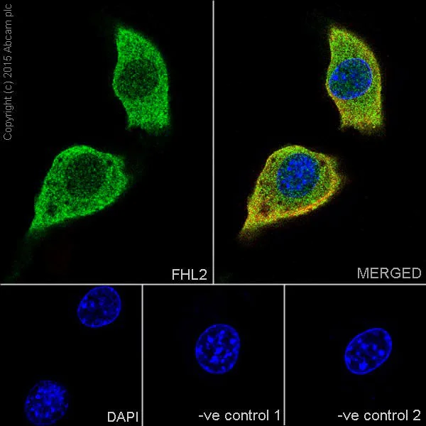 Immunocytochemistry/ Immunofluorescence - Anti-FHL2 antibody [EPR17860-23] (AB202586)