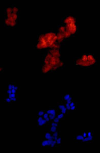 Immunocytochemistry/ Immunofluorescence - Anti-FHL3 antibody [EPR14243(B)] (AB180509), expandable thumbnail