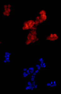 Immunocytochemistry/ Immunofluorescence - Anti-FHL3 antibody [EPR14243(B)] (AB180509)
