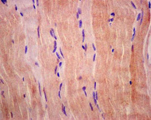 Immunohistochemistry (Formalin/PFA-fixed paraffin-embedded sections) - Anti-FHL3 antibody [EPR14243(B)] (AB180509), expandable thumbnail