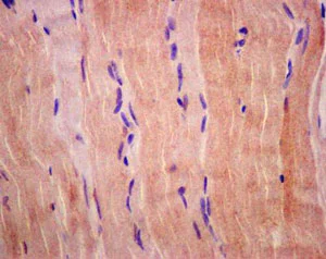 Immunohistochemistry (Formalin/PFA-fixed paraffin-embedded sections) - Anti-FHL3 antibody [EPR14243(B)] (AB180509)