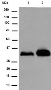 Western blot - Anti-FHL3 antibody [EPR14243(B)] (AB180509), expandable thumbnail