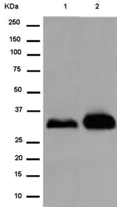 Western blot - Anti-FHL3 antibody [EPR14243(B)] (AB180509)