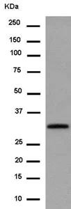 Western blot - Anti-FHL3 antibody [EPR14243(B)] (AB180509)