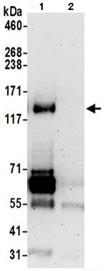 Immunoprecipitation - Anti-FHOD1 antibody (AB206692)