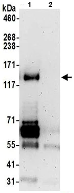 Immunoprecipitation - Anti-FHOD1 antibody (AB206692)